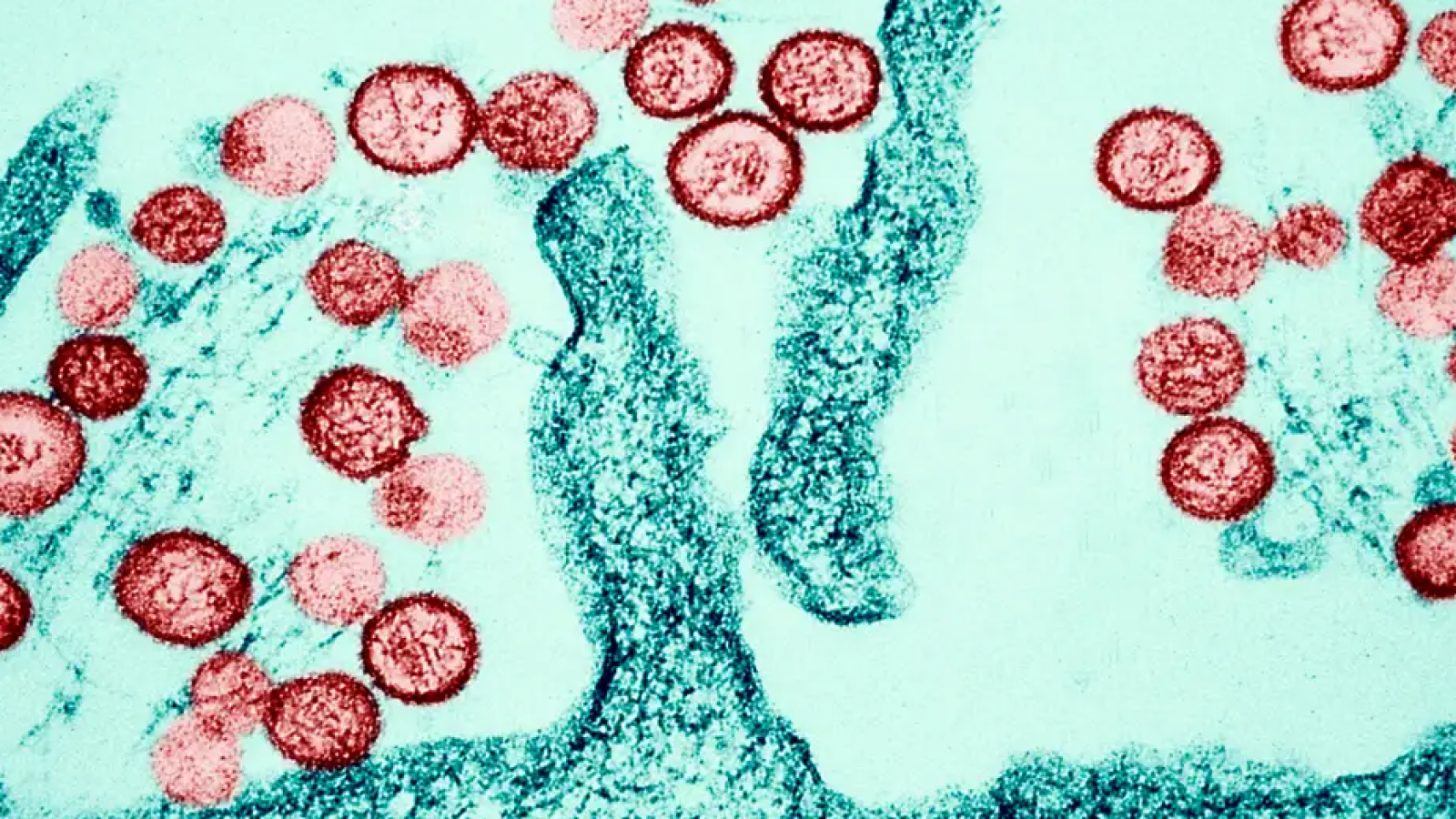 <p>Hantavirus en alta mar: qué sabemos del brote mortal</p>
