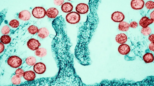 <p>Hantavirus en alta mar: qué sabemos del brote mortal</p>Hantavirus en alta mar: qué sabemos del brote mortal
