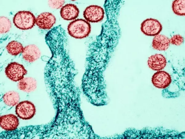 Hantavirus en alta mar: qué sabemos del brote mortal