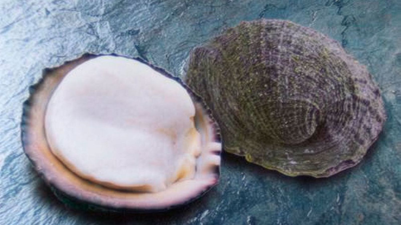 Vacuna chilena con proteína del "loco" muestra avances contra el melanoma
