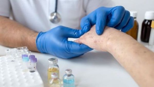 En su día mundial: ¿cómo detectar el lupus?

