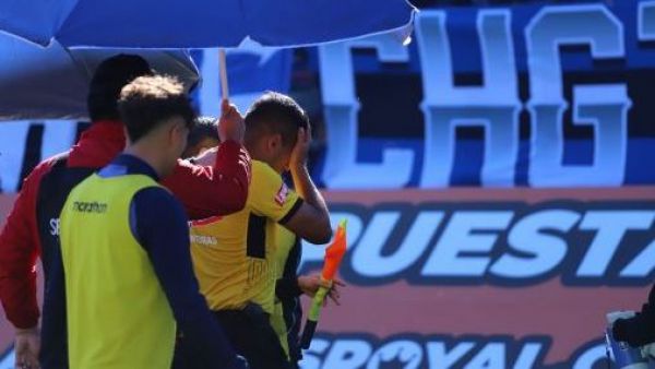 "Debido al dolor que me provocó el golpe": la denuncia que avergüenza al fútbol chileno
