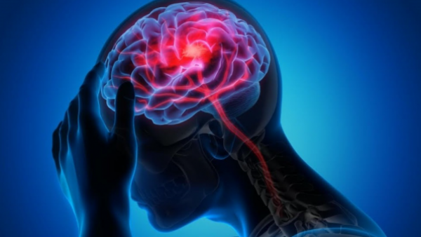 "Cuatro veces más efectivo": Llega a Chile importante avance para pacientes con epilepsia refractaria
