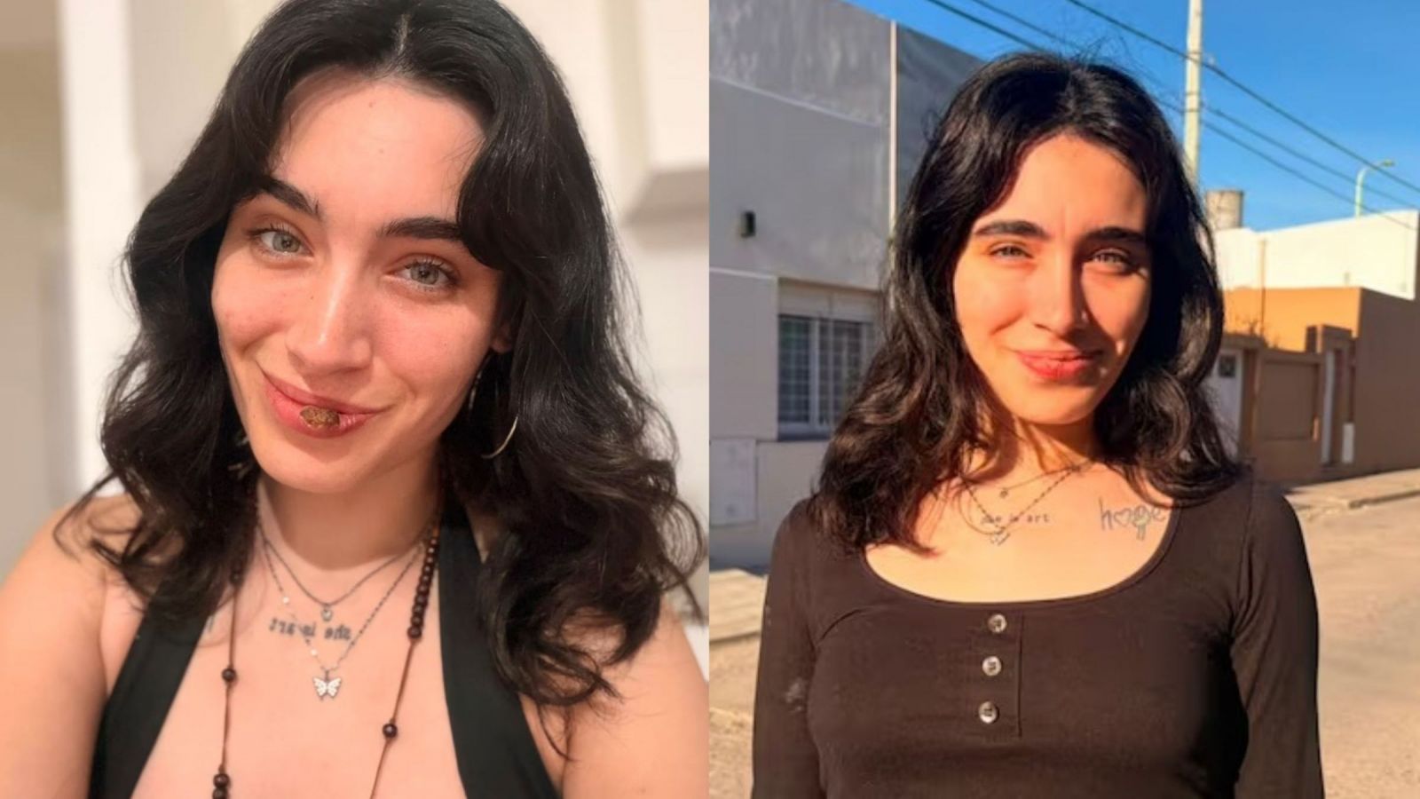 De una herida en el labio a sífilis: Joven argentina se hace viral tras contar su inesperado diagnóstico
