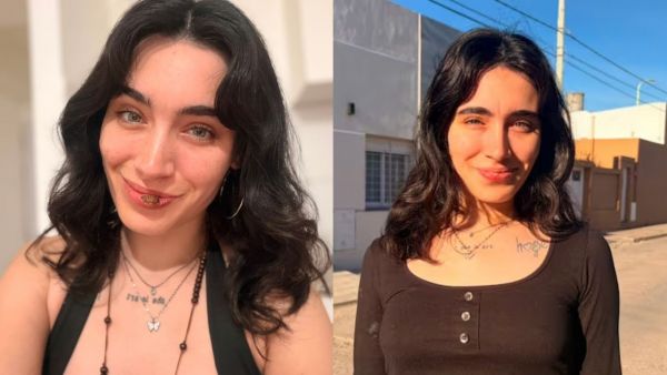 De una herida en el labio a sífilis: Joven argentina se hace viral tras contar su inesperado diagnóstico
