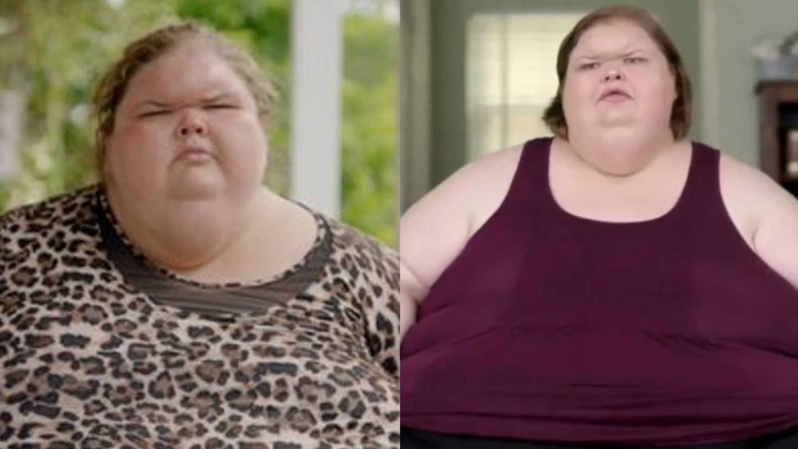 <p>Así fue la impactante transformación de una paciente de Kilos Mortales que perdió más de 220 kilos</p>
