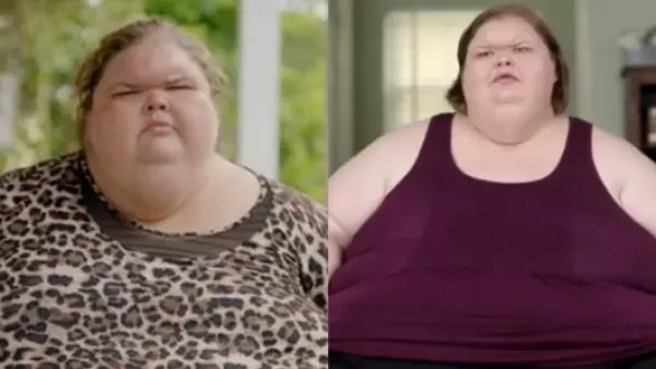 Así fue la impactante transformación de una paciente de Kilos Mortales que perdió más de 220 kilos
