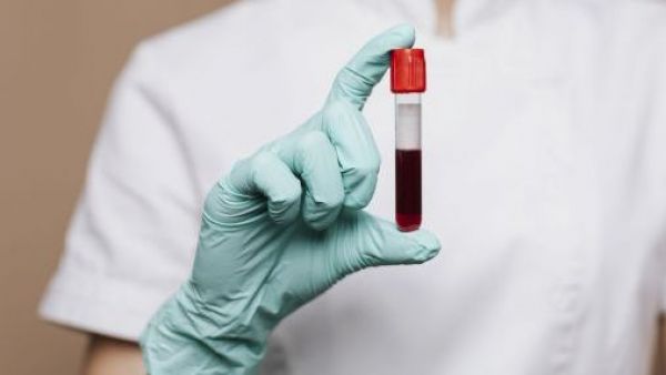 <p>Alerta por el VIH en Chile: los casos se dispararon un 86% en diez años</p>Alerta por el VIH en Chile: los casos se dispararon un 86% en diez años
