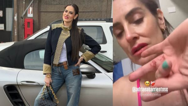 Le robaron su Porsche: Adriana Barrientos es golpeada en encerrona en Las Condes
