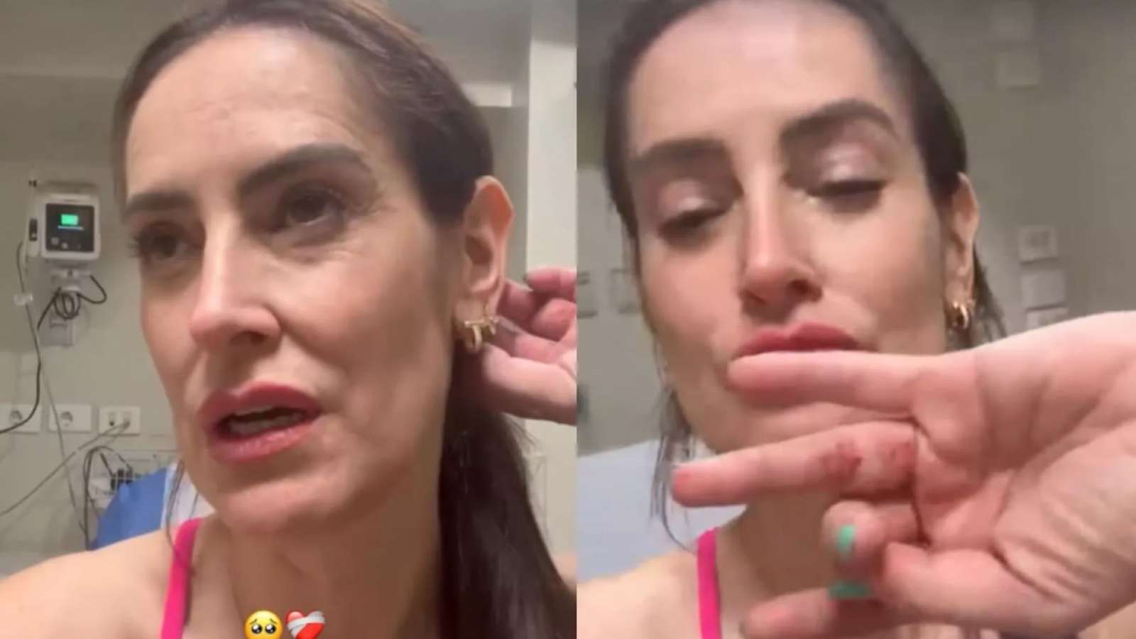 Adriana Barrientos presenta las lesiones en su cuerpo tras violenta encerrona en Las Condes
