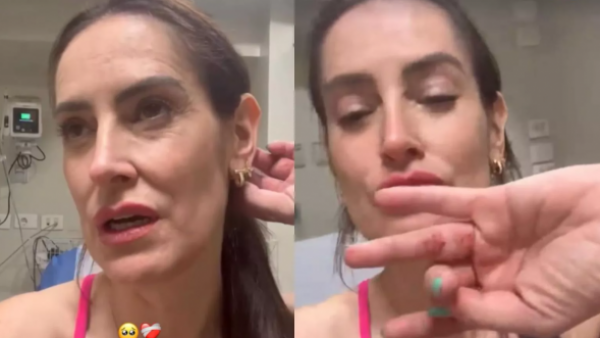 Adriana Barrientos presenta las lesiones en su cuerpo tras violenta encerrona en Las Condes
