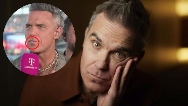 <p>Robbie Williams rompe el silencio y explicó qué era el objeto blanco que cayó de su boca</p>