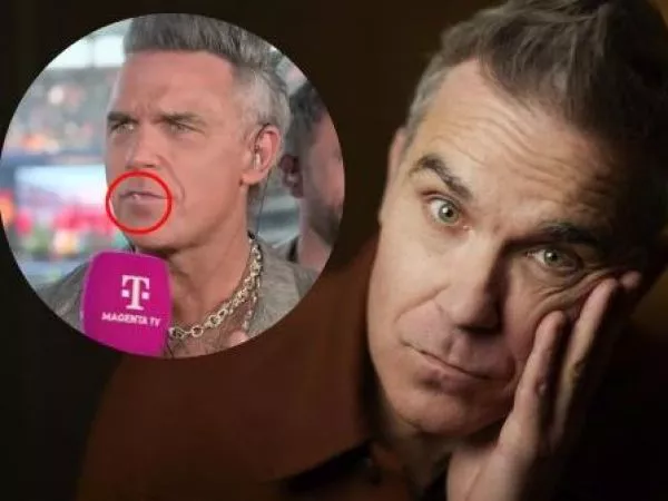 Robbie Williams rompe el silencio y explicó qué era el objeto blanco que cayó de su boca