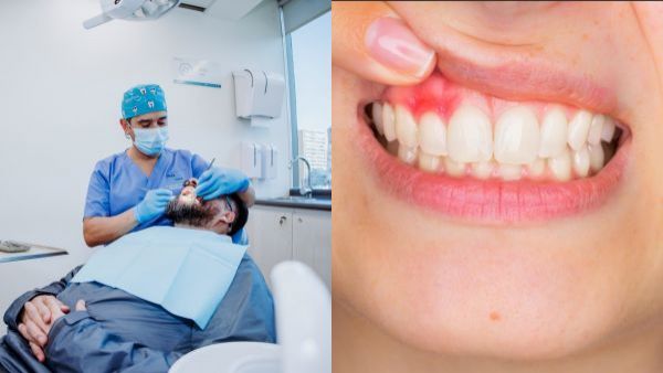<p>¿Se pueden perder dientes sanos por culpa de la periodontitis?</p>¿Se pueden perder dientes sanos por culpa de la periodontitis?
