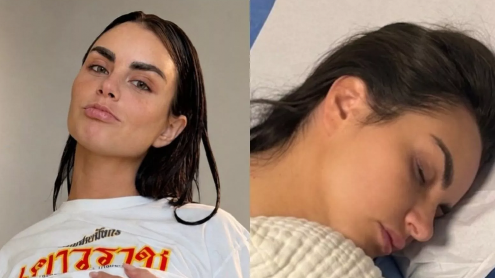 Emilia Dides se somete a compleja cirugía de urgencia
