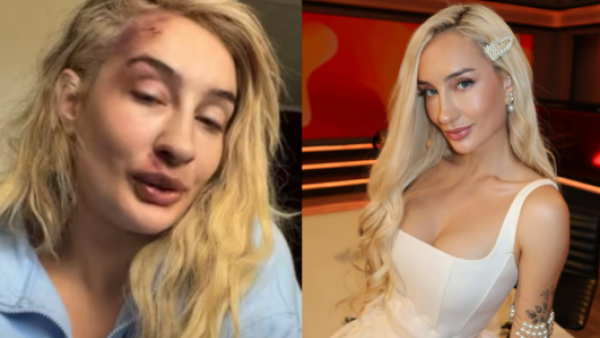 <p>Con el rostro lesionado: Fran Maira reaparece tras sufrir una golpiza</p>Con el rostro lesionado: Fran Maira reaparece tras sufrir una golpiza
