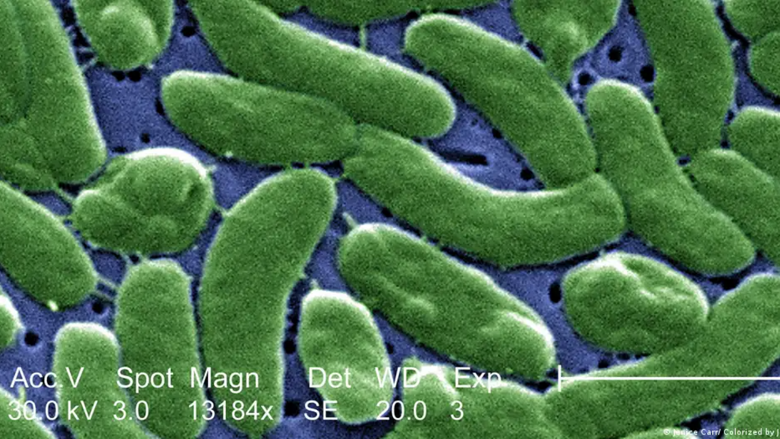 Bacteria "come carne" ya ha causado siete muertos en EE. UU.
