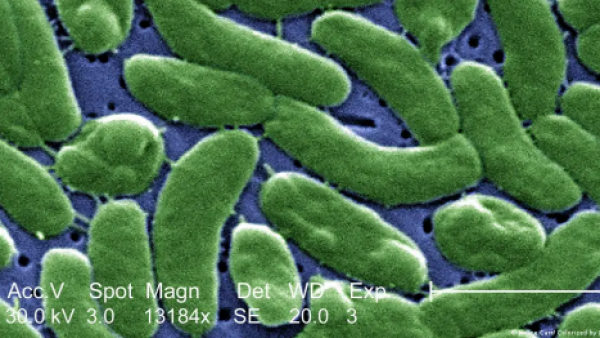 Bacteria "come carne" ya ha causado siete muertos en EE. UU.
