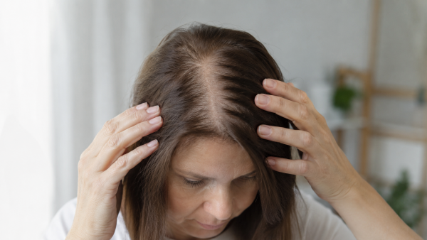 Pérdida de cabello: Qué señales deberían alertar a las mujeres después de los 50
