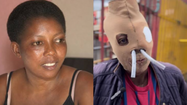 <p>María Consuelo, sobreviviente de un ataque con ácido, solicita la eutanasia tras 26 años de tratamientos y cirugías</p>María Consuelo, sobreviviente de un ataque con ácido, solicita la eutanasia tras 26 años de tratamientos
