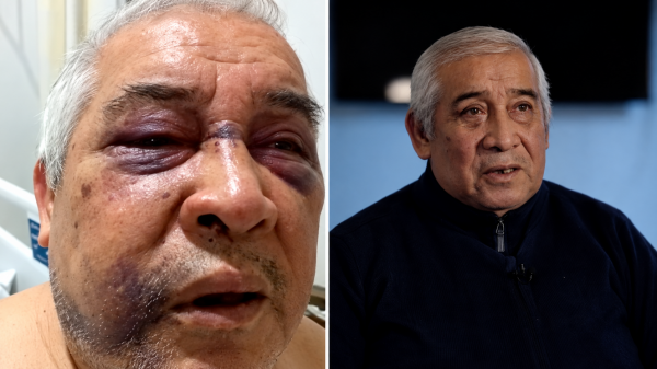Conserje agredido por Martín de los Santos habla tras su regreso a Chile: “Que termine este sufrimiento”
