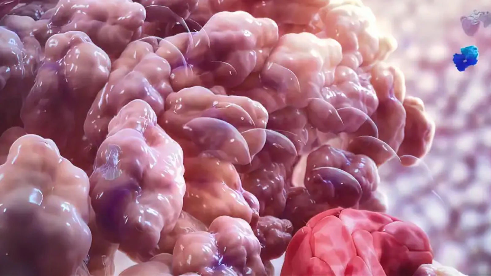 <p>Descubren cómo el cáncer puede resistir la inmunoterapia</p>
