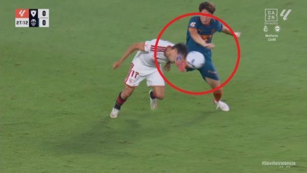 Así quedó el rostro de Gabriel Suazo tras recibir patada durante partido Sevilla vs. Valencia
