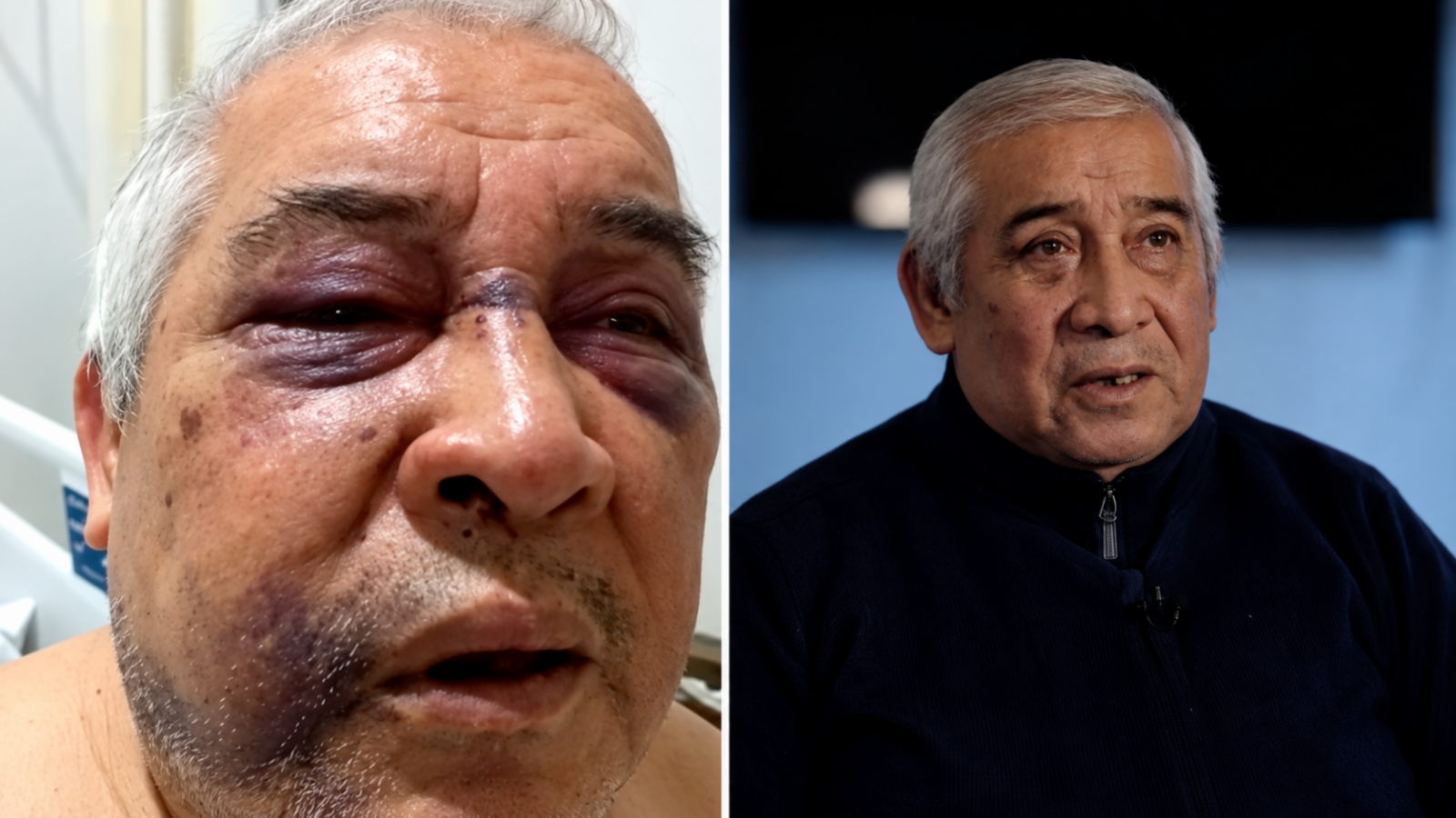 Conserje agredido por Martín de los Santos habla tras su regreso a Chile: “Que termine este sufrimiento”
