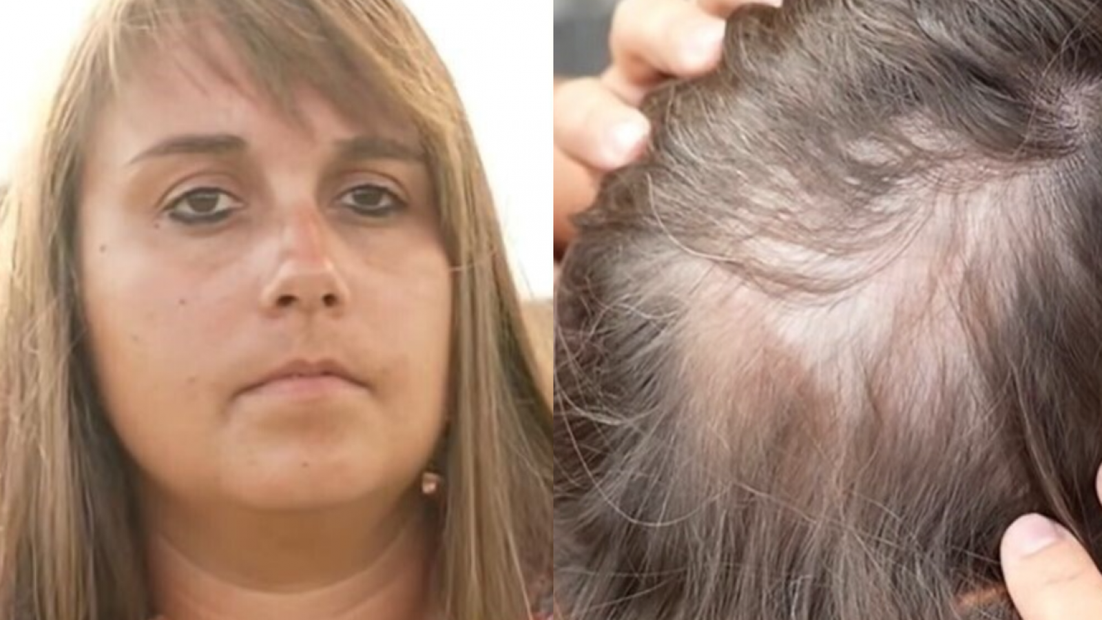 <p>Le dijeron que tenía un tumor cerebral terminal: pasó 11 años en quimioterapia y nunca tuvo cáncer</p>
