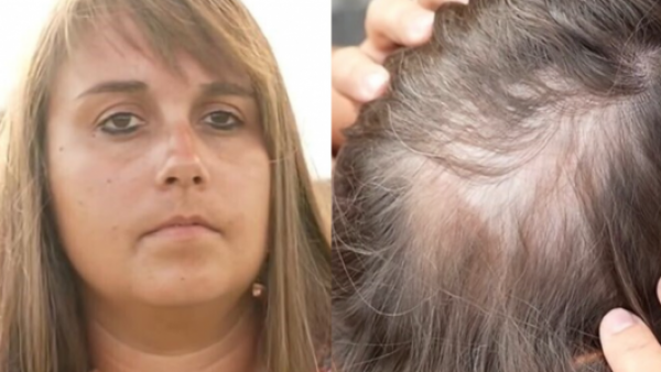 <p>Le dijeron que tenía un tumor cerebral terminal: pasó 11 años en quimioterapia y nunca tuvo cáncer</p>Le dijeron que tenía un tumor cerebral terminal: pasó 11 años en quimioterapia y nunca tuvo cáncer
