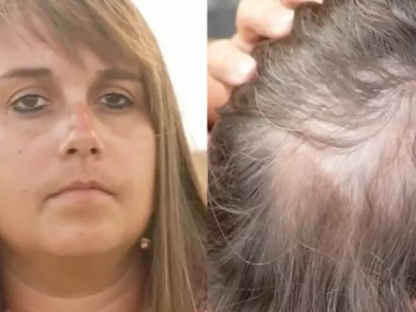 Le dijeron que tenía un tumor cerebral terminal: pasó 11 años en quimioterapia y nunca tuvo cáncer