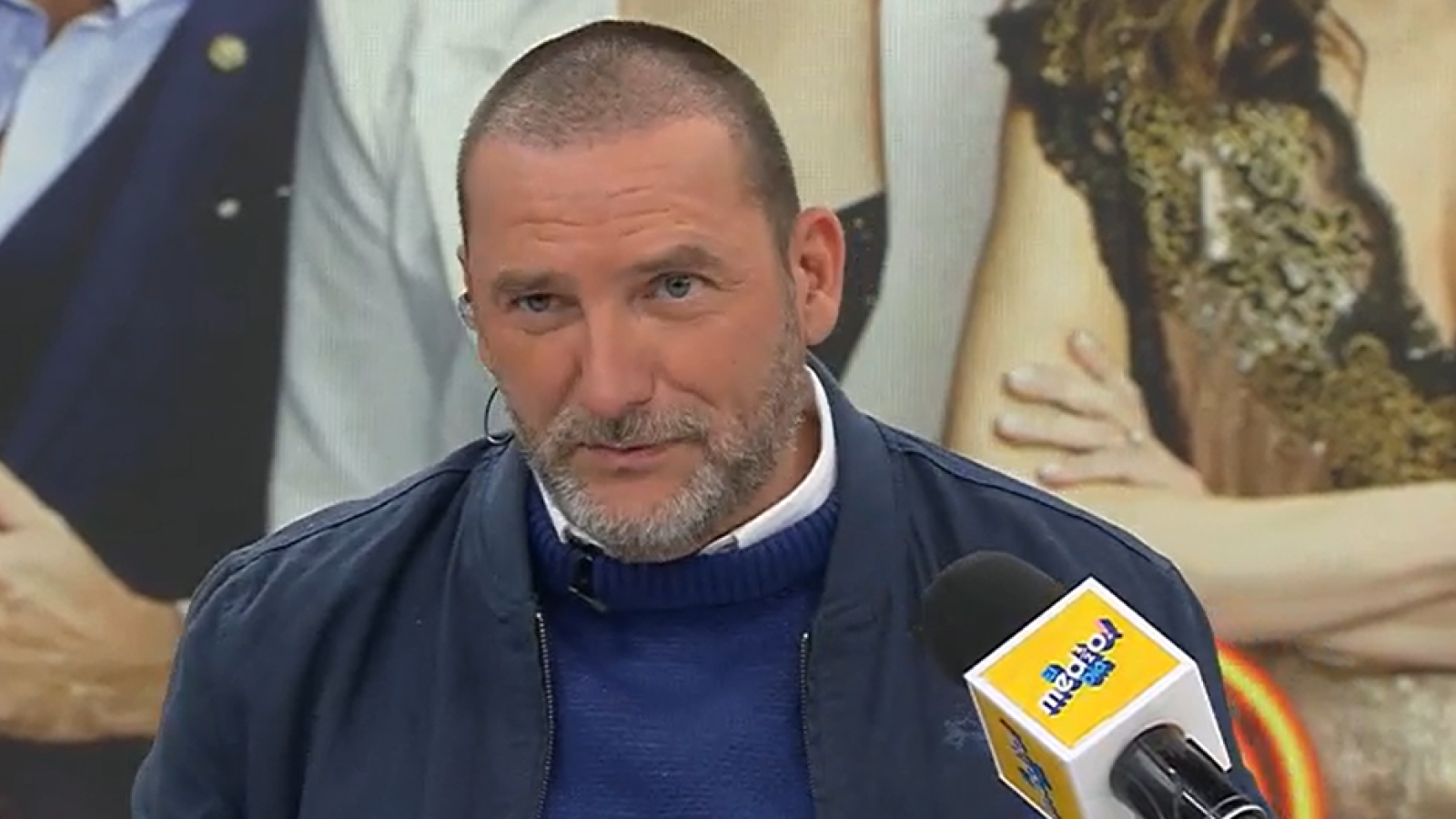 <p>Así luce Daniel Fuenzalida tras someterse a un implante de pelo</p>
