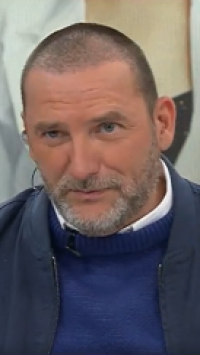 <p>Así luce Daniel Fuenzalida tras someterse a un implante de pelo</p>
