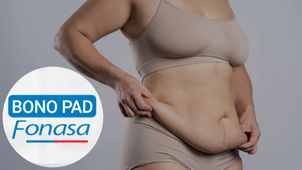 <p>Abdominoplastía con Bono PAD: cuánto cuesta y cómo acceder al financiamiento de Fonasa</p>