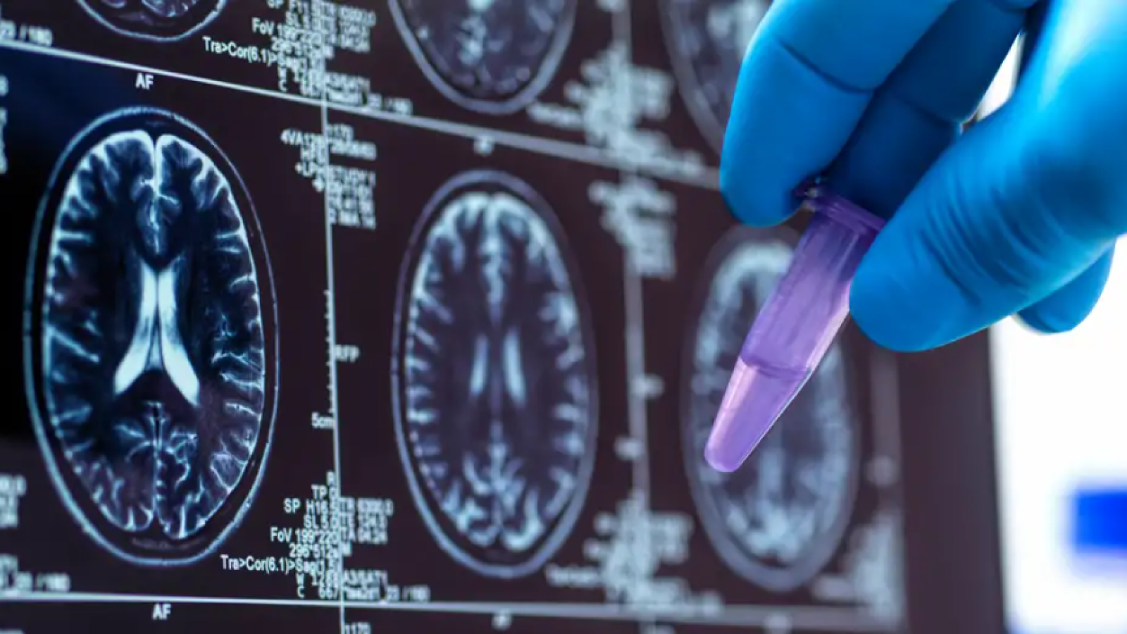 EE.UU. vigila posible brote de peste pulmonar en Rusia
