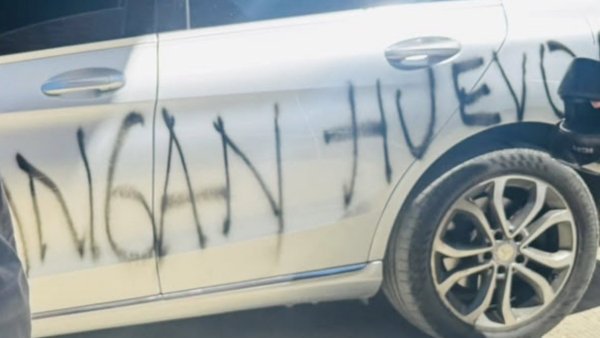 Indignación en Colombia: Así quedó el auto de exjugador de Colo Colo