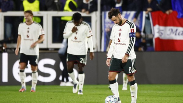 Manchester United sufrió una pesadilla en la Champions League